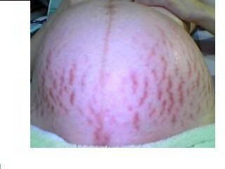 forum_wed_life_156793.jpg