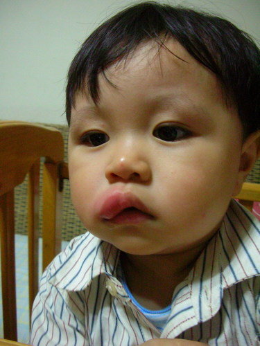 急~宝贝嘴唇肿起来!-第1页-婚后生活讨论区-非