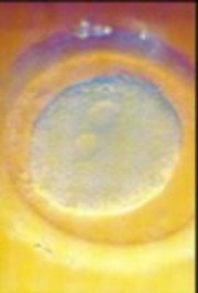 forum_wed_life_286241.jpg