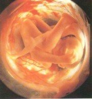 forum_wed_life_286267.jpg