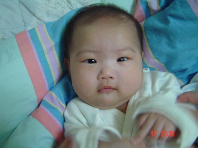 宝宝 斗鸡眼 何时会好呢?-第1页-婚后生活讨论区