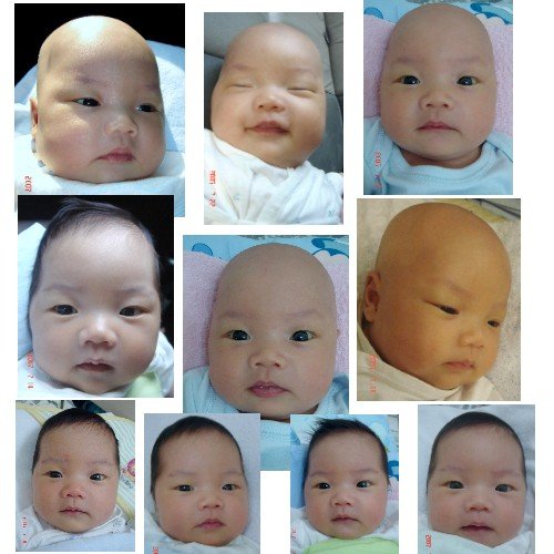 恼人的 鹅口疮 -第1页-婚后生活讨论区-非常婚礼