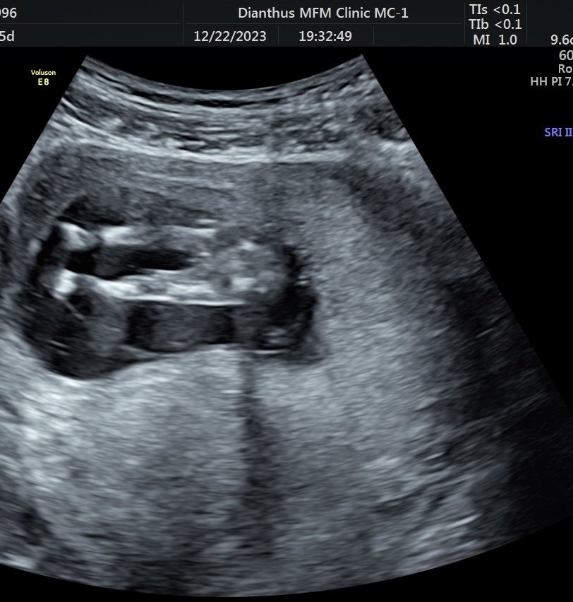 超音波是男寶還女寶-婚姻經營