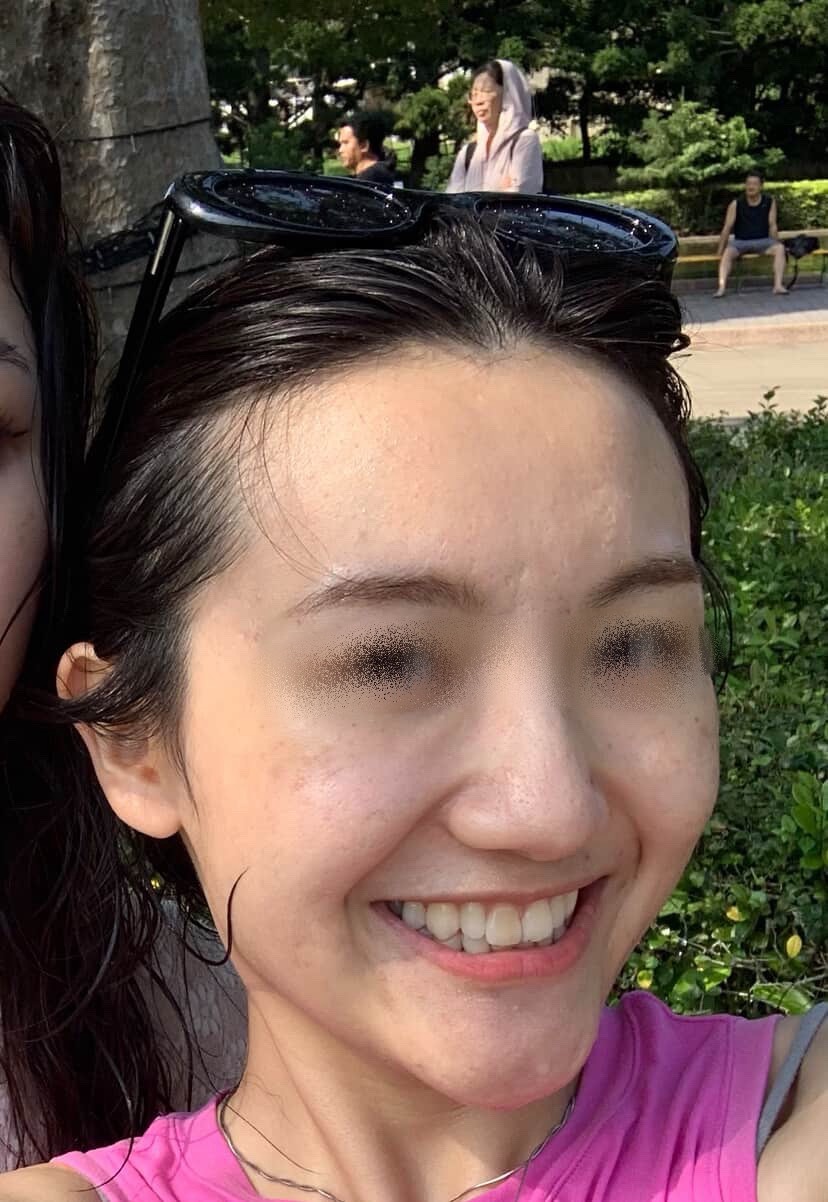 毛孔跟凹洞在燈光下真的完全藏不住-結婚經驗分享