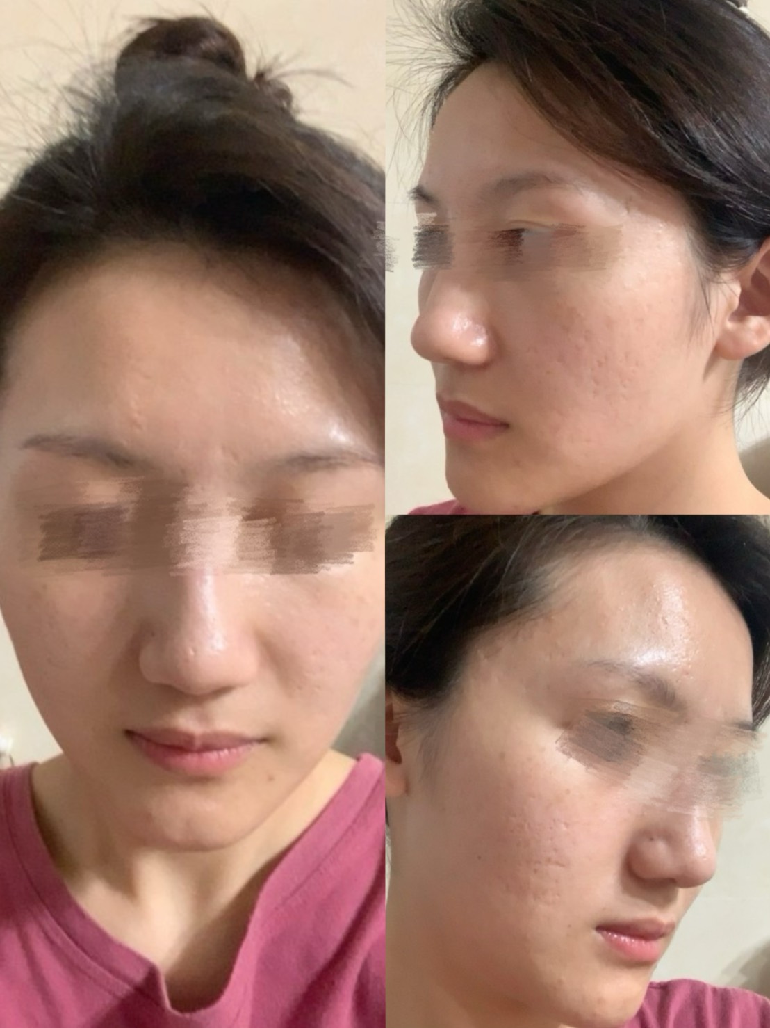 毛孔跟凹洞在燈光下真的完全藏不住-結婚經驗分享