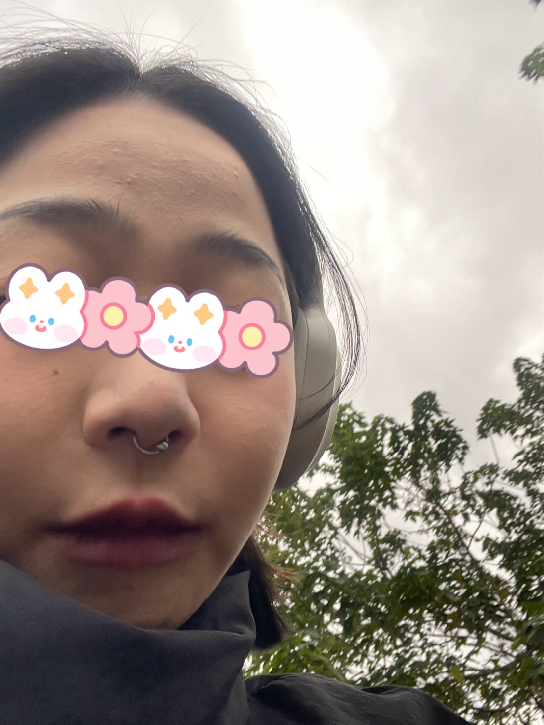 婚前第一次打肉毒,最意外的是笑起來變自然了????-結婚經驗分享