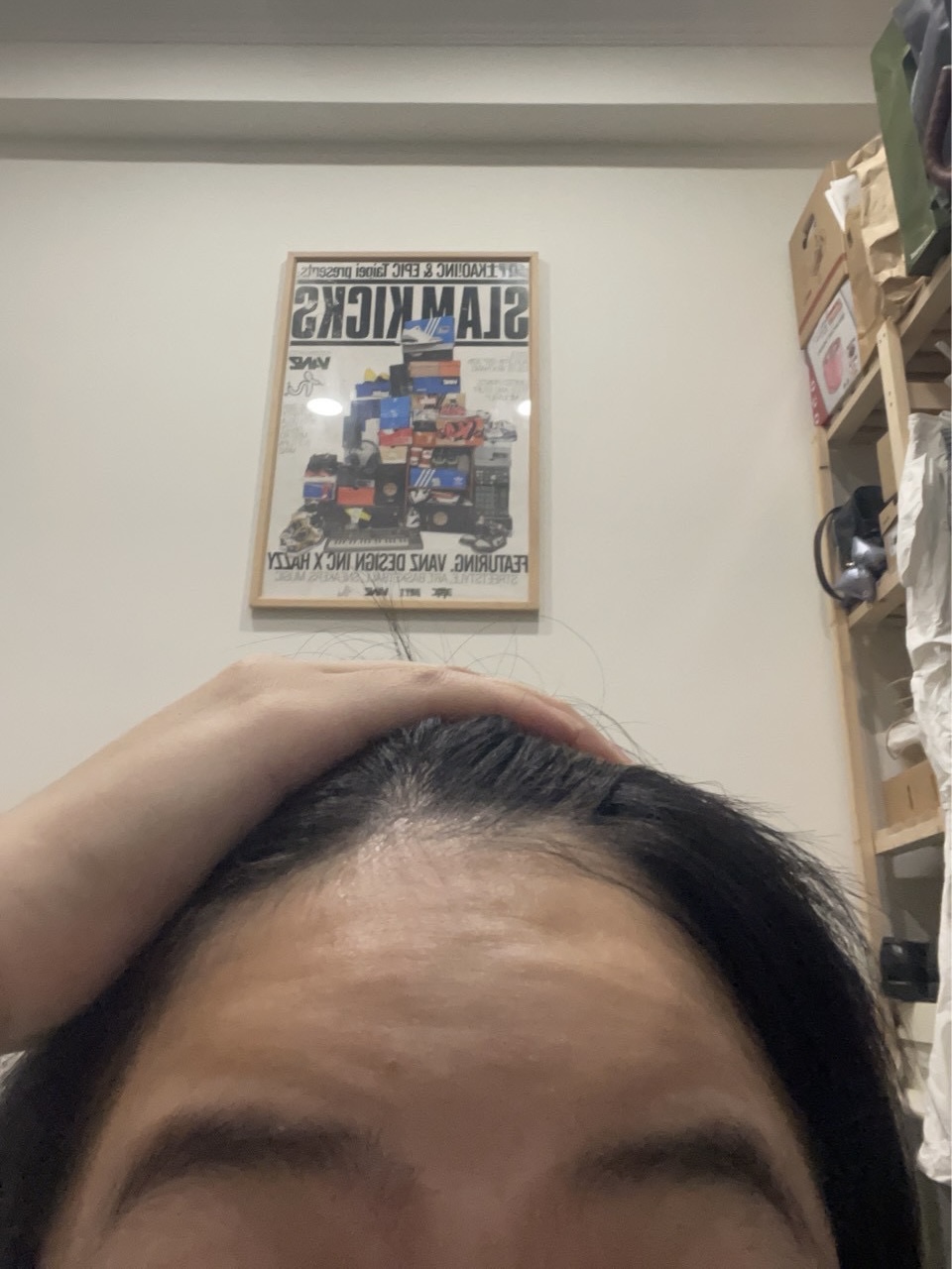 婚前第一次打肉毒,最意外的是笑起來變自然了????-結婚經驗分享